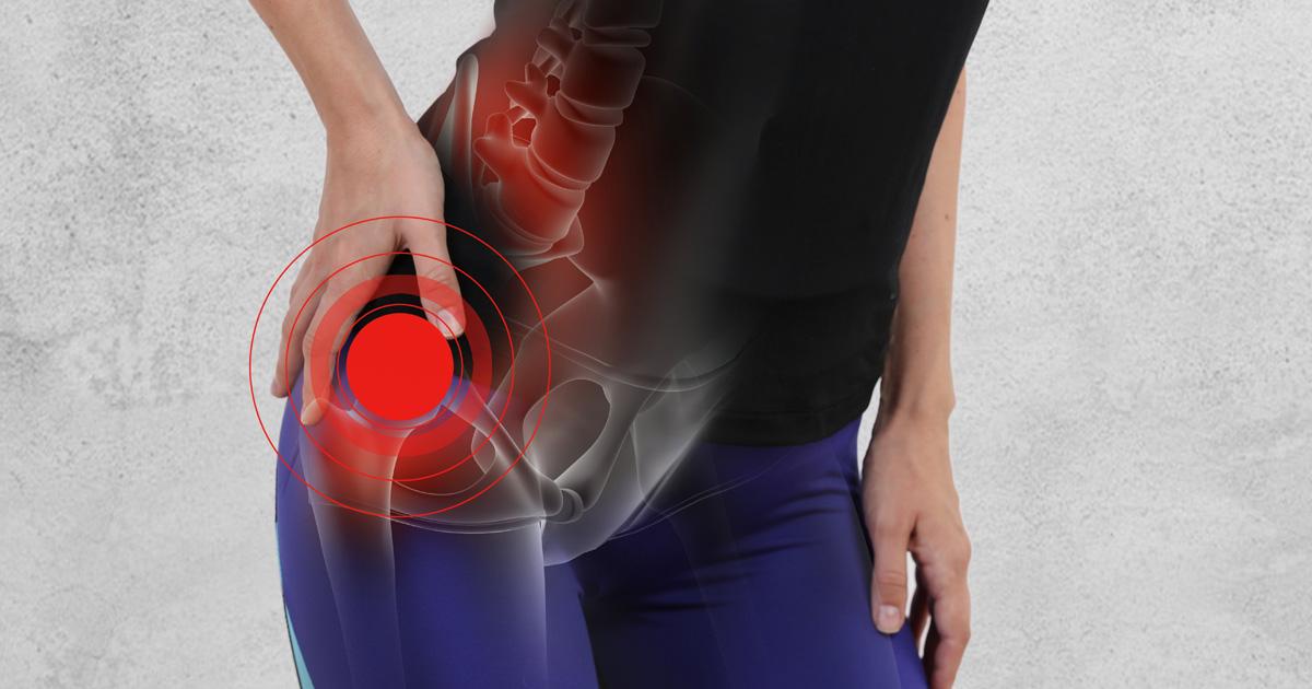 Everything About Hip Tendonitis Hip Flexor Tendonitis