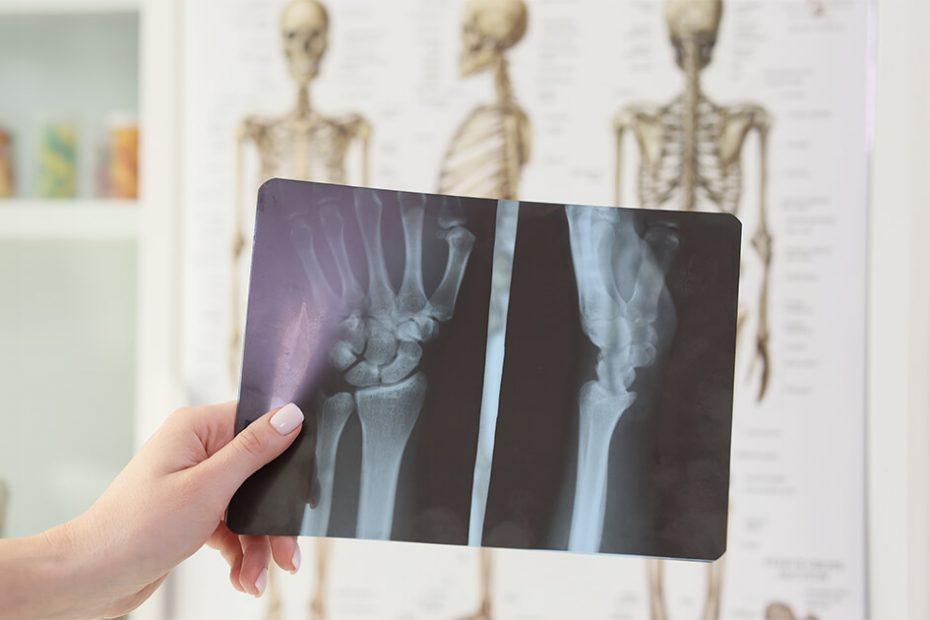 What Is The Cost Of Orthopaedic Surgery?
