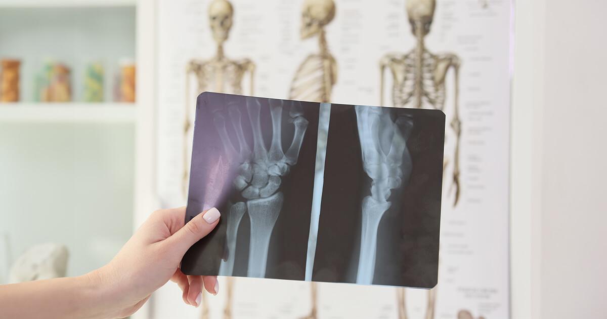 What Is The Cost Of Orthopaedic Surgery?