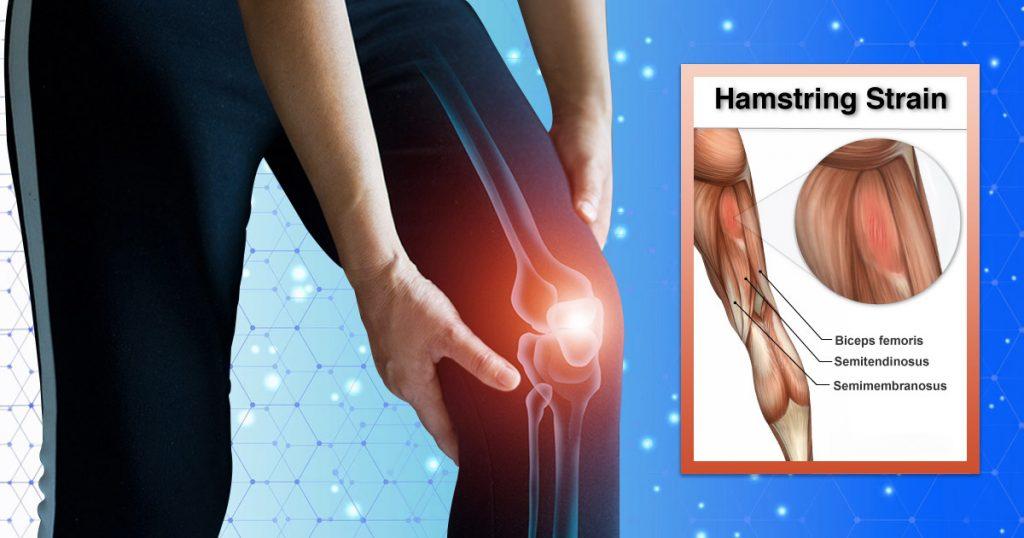 What Is Pulled Hamstring Behind Knee?