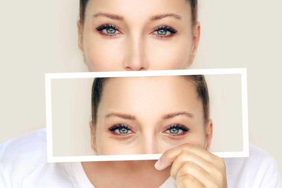 blepharoplasty-benefits