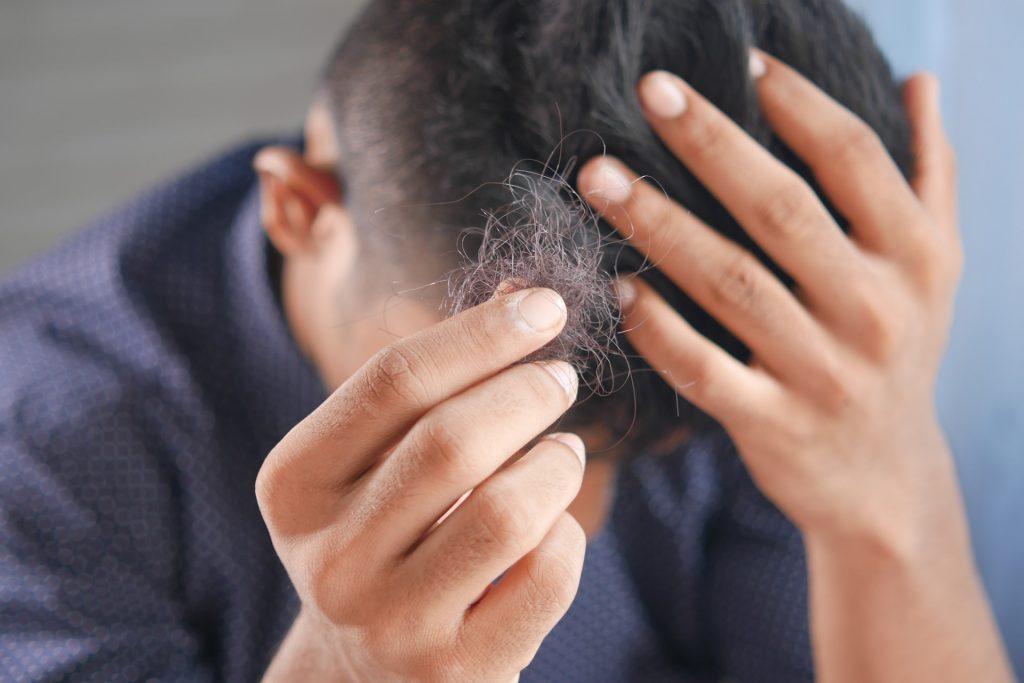 how to stop hair loss after steroid cycle