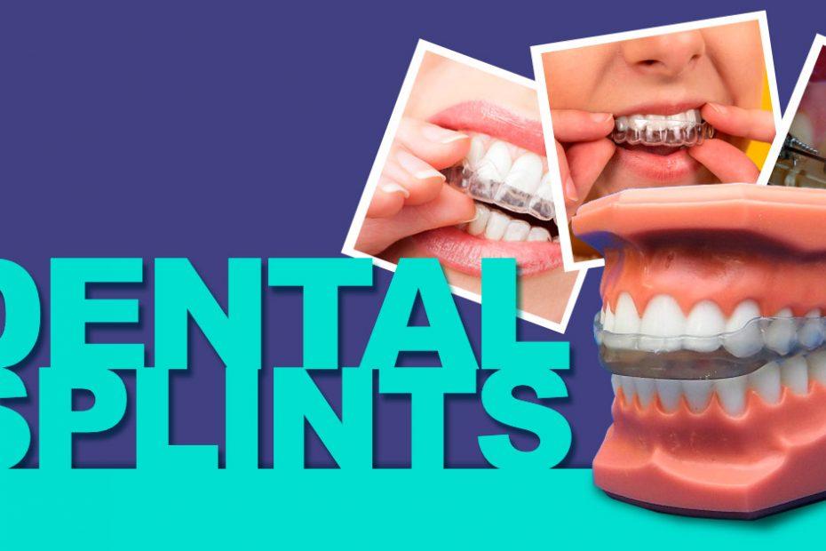 types-of-dental-splints