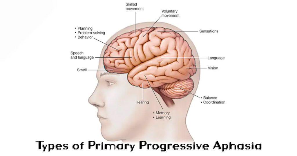 progressive-aphasia-treatment