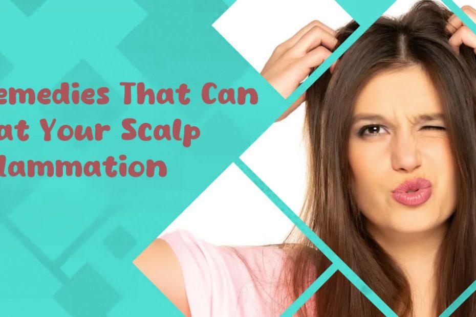 how to stop scalp inflammation