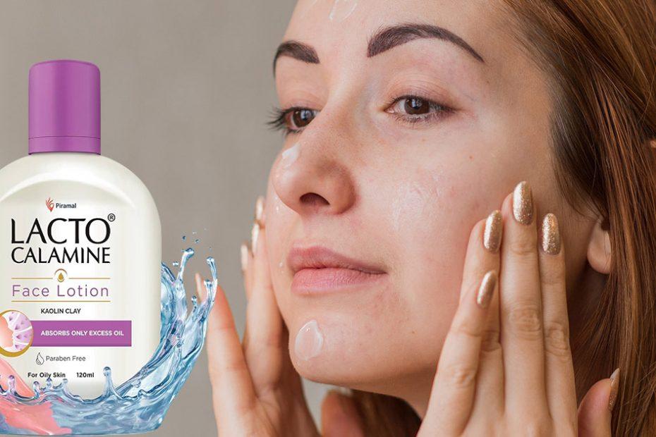 is calamine lotion good for acne