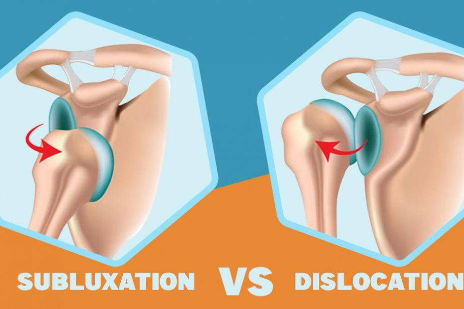 subluxation vs dislocation