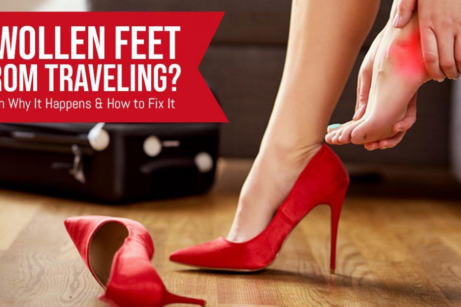 swollen feet from traveling