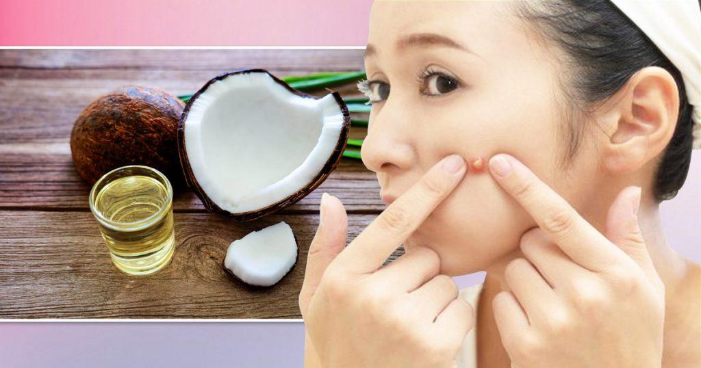 how to use tea tree oil for boils