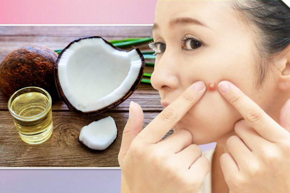 how to use tea tree oil for boils