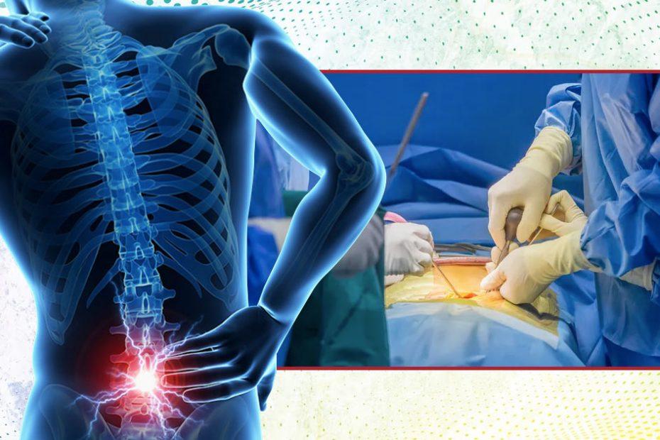 new procedure for spinal stenosis