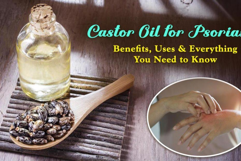 castor oil for psoriasis