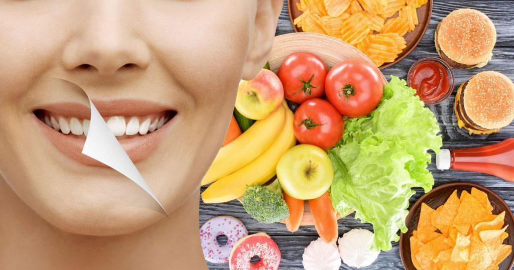 what to eat after tooth whitening