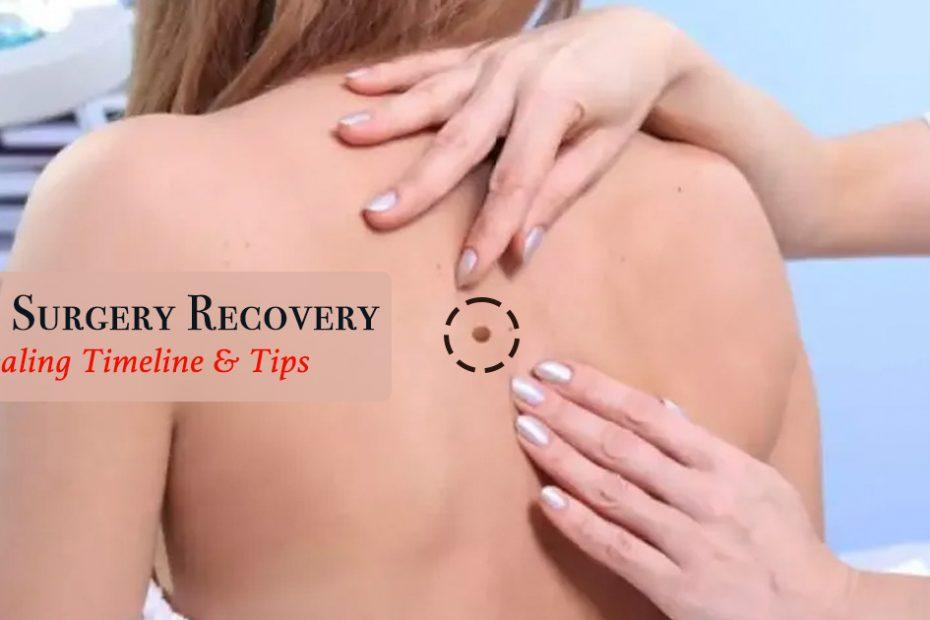 mohs surgery recovery