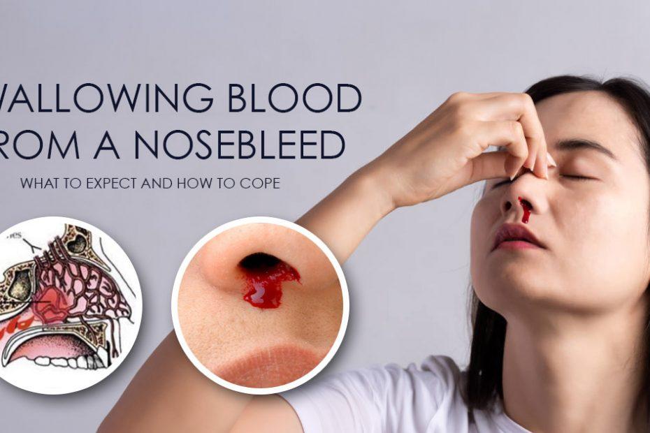 swallowing blood from a nosebleed