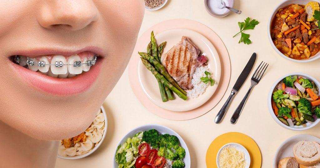 what to eat with braces