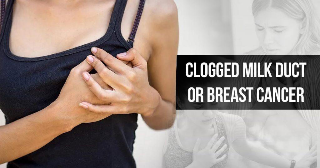 clogged-milk-duct-or-breast-cancer