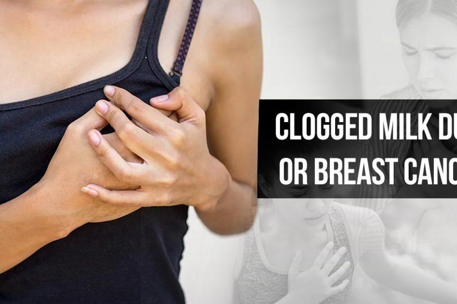 clogged-milk-duct-or-breast-cancer