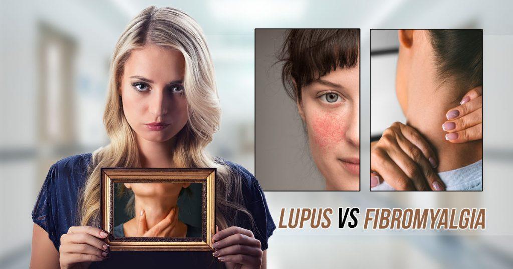 lupus vs fibromyalgia