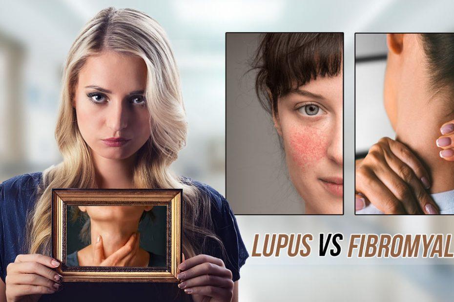 lupus vs fibromyalgia