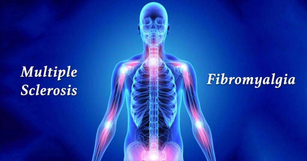 multiple sclerosis vs fibromyalgia