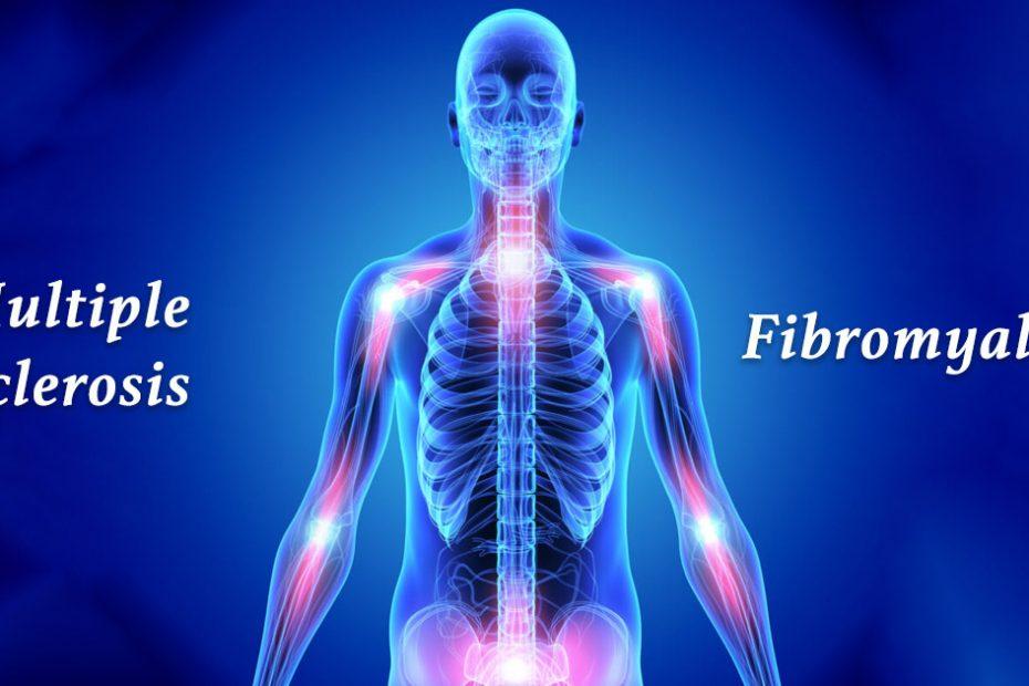 multiple sclerosis vs fibromyalgia