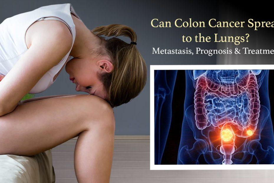 colon cancer spread to the lungs