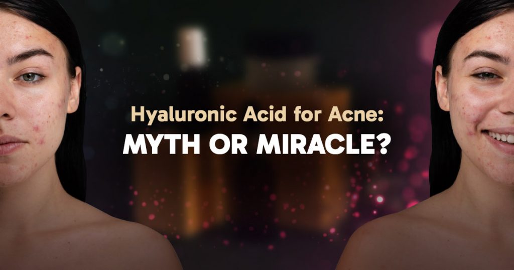 hyaluronic-acid-for-acne