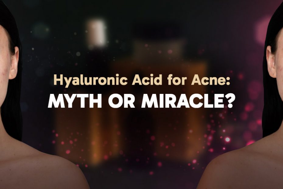 hyaluronic-acid-for-acne