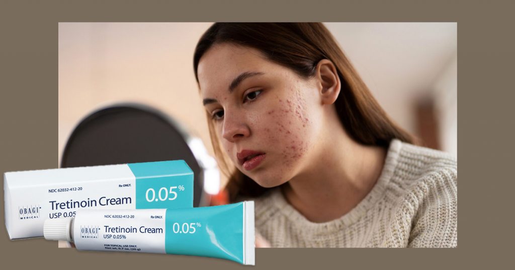 tretinoin for acne