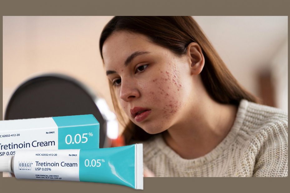 tretinoin for acne