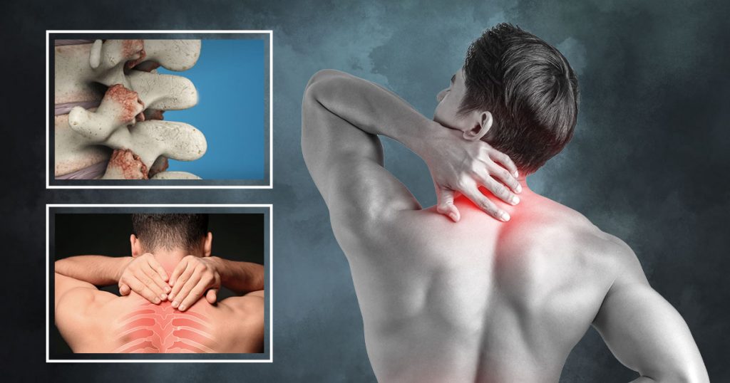 facet joint pain treatment