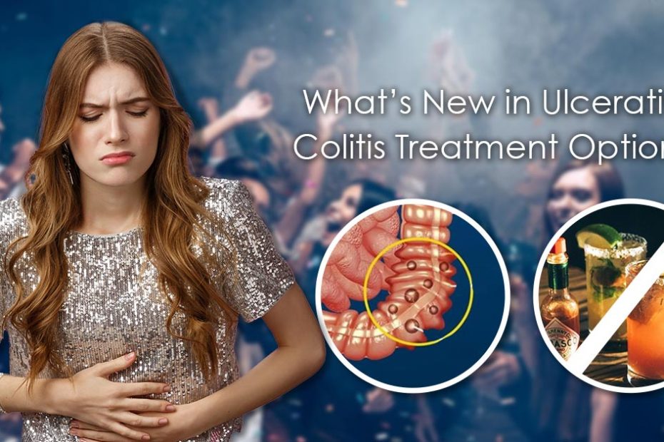 what is the latest treatment for ulcerative colitis?