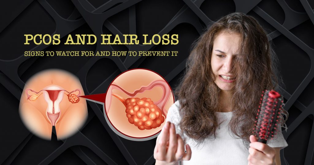 pcos-and-hair-loss