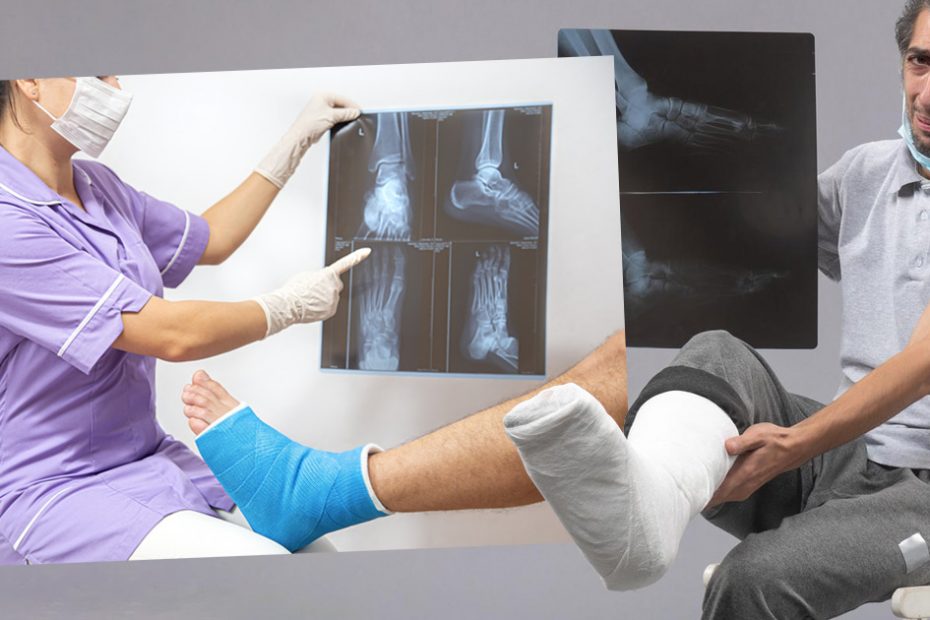bone lesions explained