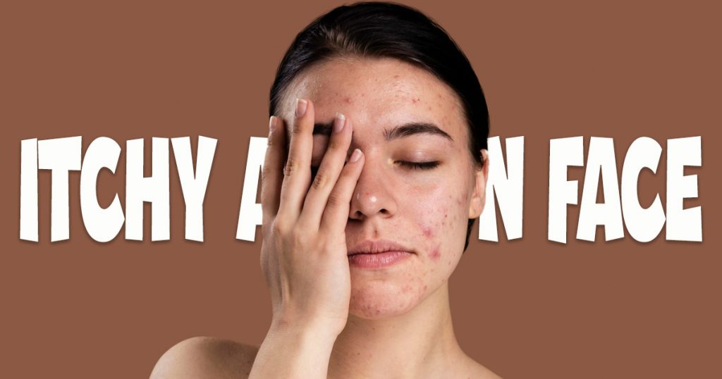 itchy acne on face