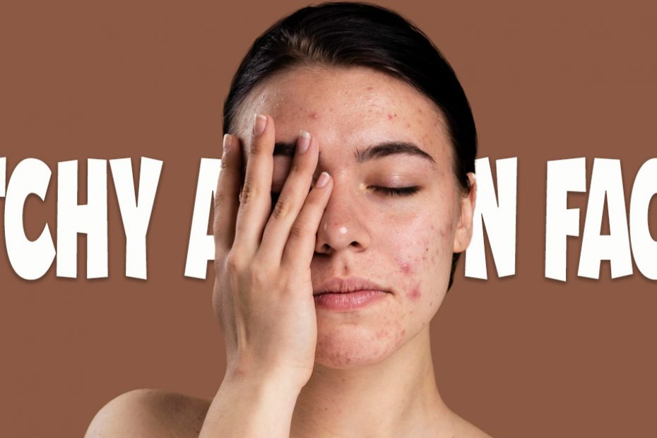 itchy acne on face
