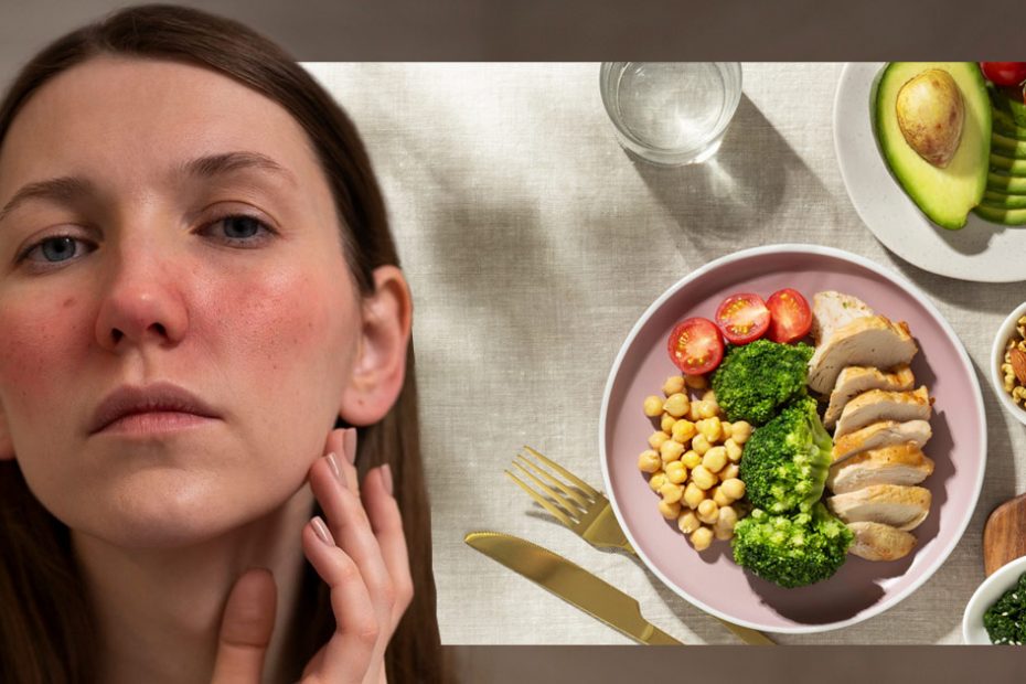 natural-remedies-for-lupus
