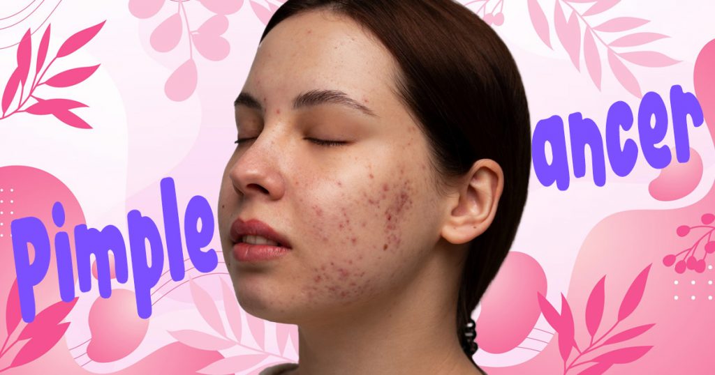 pimple or skin cancer