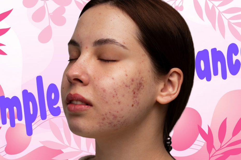 pimple or skin cancer