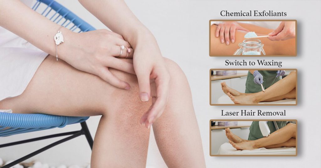 strawberry-legs-treatment