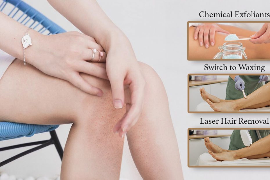 strawberry-legs-treatment