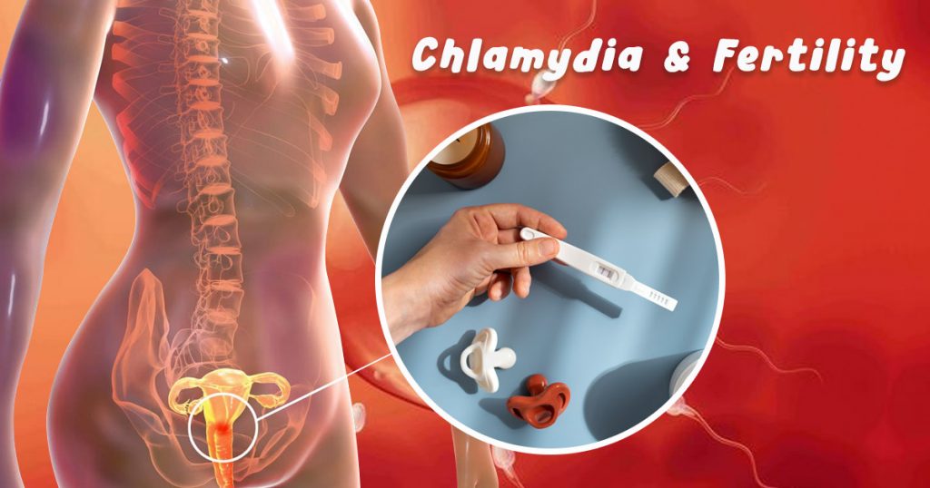chlamydia & fertility