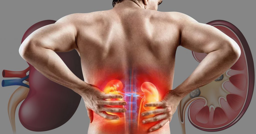 How long can you live in kidney failure without dialysis