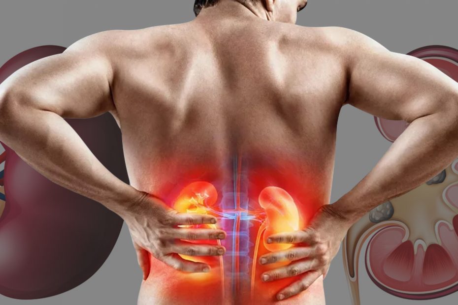 How long can you live in kidney failure without dialysis