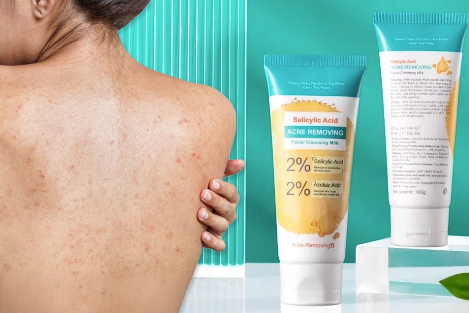 body-acne