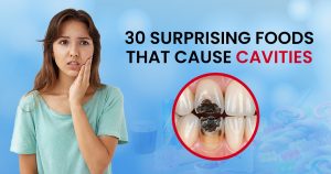 What foods cause cavities