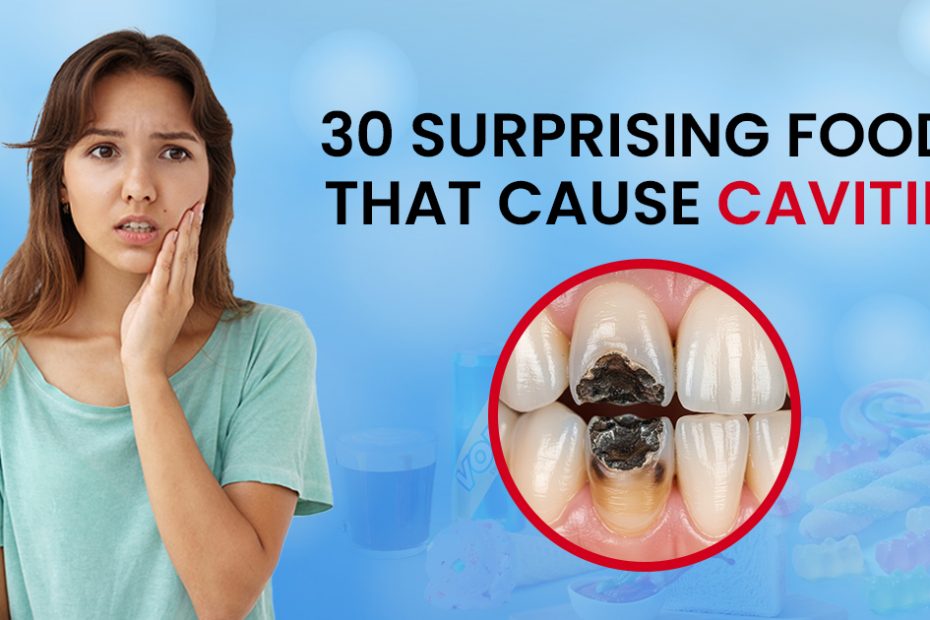 What foods cause cavities